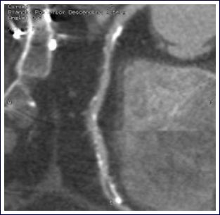 Cardiac CT Oxford Interventional Radiology